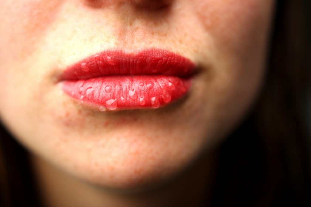 Lips 1